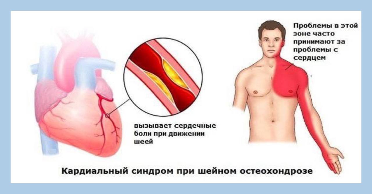 Болит сердце после зала