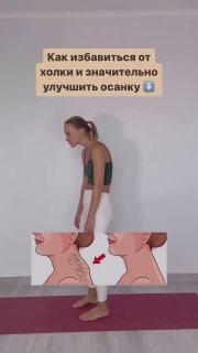 Связь прикуса и осанки